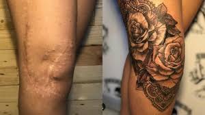 Maybe you would like to learn more about one of these? Egyptian Tattoo Artist Draws Flowers Butterflies To Hide Burns Al Monitor The Pulse Of The Middle East