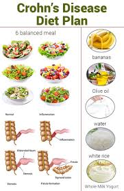 Pin On Crohn S Disease Stuff