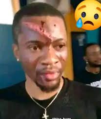 🔥Artiste Musicien Congolais Gaz Mawete serait agressé par une personne non  identifié jusqu'à présent 💔asali bino nini pas jusqu'à ce niveau 😭.