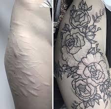 But for people whose stretch marks get in the way of them being their most confident selves — and there's no shame in that either, because that's just as common — there's rudolph torres. 211 Amazing Tattoos That Turn Scars Into Works Of Art Bored Panda