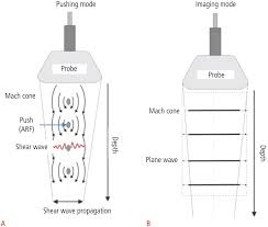 Figures And Tables