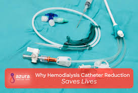 The device is meant to be permanent and that is what our efforts are pushing hdu works tirelessly within today's legal and medical systems to advocate for and inform dialysis patients about their options for dialysis care. Why Hemodialysis Catheter Avoidance Saves Lives Azura Vascular Care