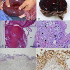 Pdf Pathological Findings Of Hemorrhagic Bowel Syndrome Hbs In Six Dairy Cattle Cases