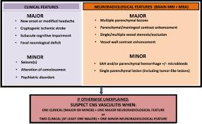 Boğaziçi university derpartment of turkish language and literature. When Should Primary Angiitis Of The Central Nervous System Pacns Be Suspected Literature Review And Proposal Of A Preliminary Screening Algorithm Springerlink