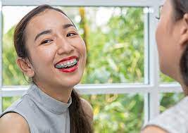 If you feel theyre too tight talk to your orthodontist then. Uncategorized