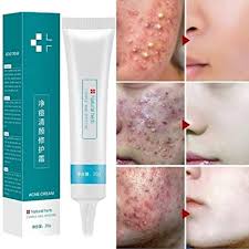 Yissma Crema Para El Acne Crema Para Eliminar Cicatrices De Acne Crema Para Espinillas Gel Tratamientos Para El Acne Crema Hidratante Para Reducir Los Poros Para Adultos Y Adolescentes Amazon Es Belleza