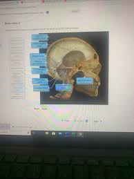 Supplies the posterior brain, blood supply to the entire brain is ensured by anastomoses between the vessels. Solved Etmeducation Com Flow Connect Html Cises 32 34 Chegg Com