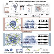 Image result for CSF Culture