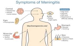 Pin By Mayedul Islam On Nursing Exercise Meningitis Stomach Nausea Intracranial Pressure
