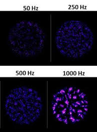 For instance, the tube lights we use at home have plasma in them. The Fourth State Of Matter Plasma A Technology To Improve Bone Healing