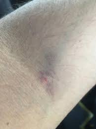 Serum Takilan Kol Morlugu Cok Fazla Degil Mi Kizlarsoruyor