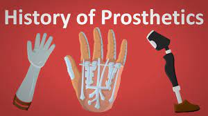 We did not find results for: How Do You Spell Prosthesis