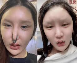 It can make them look more likeable, trustworthy and feminine, researchers say. Net Red Spent 860 000 Plastic Surgery Failed Seeing What It Looked Like Before Netizens It S Hard For A Cosmetic Surgeon Daydaynews