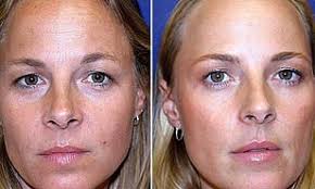 D.I.Y. dialysis machine built in doctor's garage gives miracle Millie a  shot at life