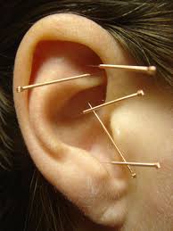 Pin On Acupuncture