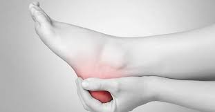 Et c'est grâce aux talons que nous avons de l'appui, du soutien. Mal Au Talon Et Si C Etait Une Aponevrosite Plantaire Le Point