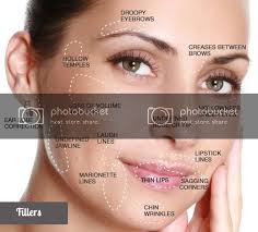 Botox injections near me in ashland, or. The Choice Of Dermal Fillers Or Botox According To The Area To Be Treated Aesthetics Hub Dermal Fillers Botox Forehead Wrinkles