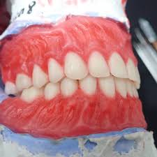 Broo and sis.om and tante.kakek and nenek yg mau buat gigi palsu atau sekedar sharing masalah gigi silahkan wa/tlpn atau datang langsung ke tkp jg boleh. Delta Dental Laboratory Laboratorium Gigi
