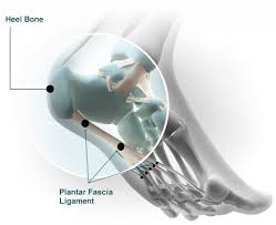 It is an extremely painful situations daily. Plantar Fasciitis Shoes Z Coil S Stop Plantar Fasciitis