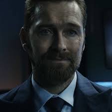 LYNCH'S MUSTACHE LOOKS STUPID !!