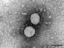 See more on yahoo news » What S Different About The Hyper Infectious Delta Coronavirus Variant The Mainichi