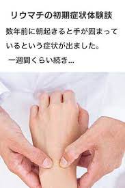 リウマチの体験談 更年期 症状 関節リウマチ 健康になる