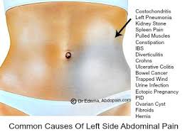 The abdomen (colloquially called the belly, tummy, midriff or stomach) is the part of the body between the thorax (chest) and pelvis, in humans and in other vertebrates. Pin On Books Worth Reading