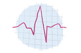 Ecg Electrocardiogram When You Need It And When You Dont