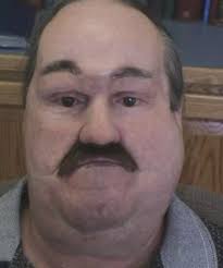 Kentucky man left with 'no face' after contracting infection that has 50%  mortality rate