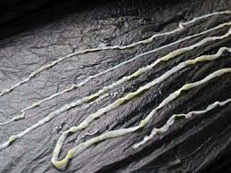 Sie stellen eine klasse dar, die zum stamm der plattwürmer ( plathelminthes. Arzte Ziehen Patient 1 88 Meter Langen Bandwurm Aus Dem Mund Gesundheit