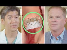 TAVR vs SAVR: Jim Whitney's Bicuspid Aortic Valve Patient Success Story  (with Dr. Chris Malaisrie)