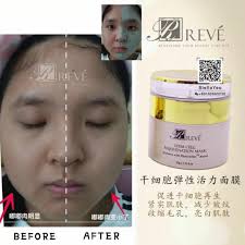 看看宝贝敷了半边脸的效果😱 #嘟嘟肉15分钟立即变小了👍 在这V脸的时代，要跟嘟嘟脸说再见！👋 V脸的神器《#