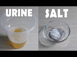 Home Pregnancy Test With Salt In Telugu Pregnancy Test Kit