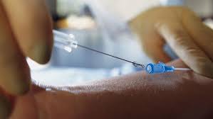 Image result for IV Access