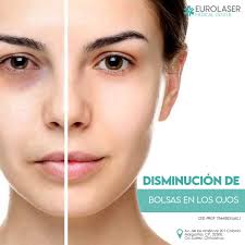 Eurolaser Clinica de Medicina Estética en Cd. Juárez