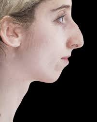 Nima Naghshineh, MD, FACS