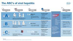Some people or animals with hepatitis have no symptoms, whereas others develop yellow discoloration of the skin and whites of the eyes (jaundice). Pin On Research
