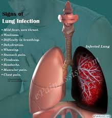 Signs Of Lung Infection Lung Infection Chest Infection Infections