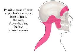 How To Get Rid Of Tension Headache With Pictures Tension Headache Migraine Headaches Migraine Relief