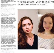 Although the exact cause of thyroid cancer is yet unknown, certain possible factors increase the risk of getting this fatal condition which includes exposure to extreme levels of radiation, a family history of. Thyroid Cancer Symptoms Girl Posts Photo Showing Hidden Sign Of Rare Cancer Express Co Uk