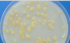 Image result for tomato seedling xanthomonas vesicatoria