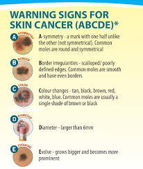 Learn more about targeted therapy, surgery, and chemotherapy. Be Sunsmart Everywhere Cansa The Cancer Association Of South Africa Cansa The Cancer Association Of South Africa