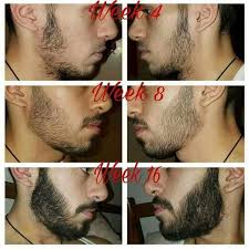 To choose the right style of beard, it is important to understand that the goal is to bring for face oval shape will suit any minoxidil before and after beard. Kirkland 5 Minoxidil Abuja Nigeria Home Facebook