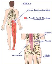 These are the extrinsic muscles and the these are your lower to mid back area, the abdominals and side abdominals and the hip region. Back Pain Causes Treatments Prevention Eruptingmind