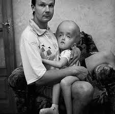 Within three months of the chernobyl accident, a total of 31 people died from radiation exposure or other direct effects of the disaster, according to the nrc. 24 Chernobyl Ideas Chernobyl Chernobyl Disaster Nuclear Disasters