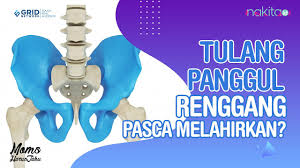 Sakit di pinggul sebelah kiri maupun di sebelah kanan bisa terjadi pada siapa saja, pasien kang abay saat ini mengalami sakit di. Tulang Panggul Renggang Sampai 1 Cm Lebih Pasca Melahirkan Sebabkan Susah Jalan Semua Halaman Video