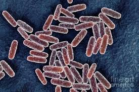 Image result for yersinia fotos