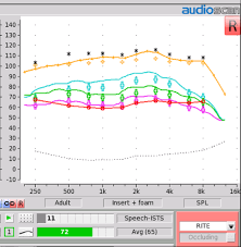 20q Using The Aided Speech Intelligibility Index In Hearing