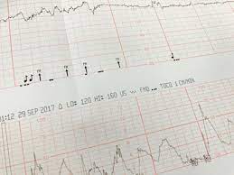 May 11, 2021 · a walk through history. Nst Afi Antenatal Testing Oc Women S Medical Group