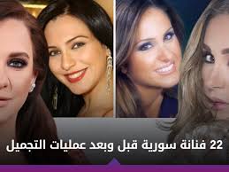 نسرين طافش قبل عمليات التجميل. ØµÙˆØ± 22 ÙÙ†Ø§Ù†Ø© Ø³ÙˆØ±ÙŠØ© Ù‚Ø¨Ù„ ÙˆØ¨Ø¹Ø¯ Ø¹Ù…Ù„ÙŠØ§Øª Ø§Ù„ØªØ¬Ù…ÙŠÙ„ Ø¯Ø§Ø± Ø§Ù„Ø­ÙŠØ§Ø© Ø§Ø®Ø¨Ø§Ø± ÙÙ„Ø³Ø·ÙŠÙ† Ø§Ø®Ø¨Ø§Ø± Ø§Ù„Ù…Ù…Ù„ÙƒØ© Ø§Ù„Ø¹Ø±Ø¨ÙŠØ© Ø§Ù„Ø³Ø¹ÙˆØ¯ÙŠØ© Ø§Ø®Ø¨Ø§Ø± Ø§Ù„Ø¹Ø§Ù„Ù…